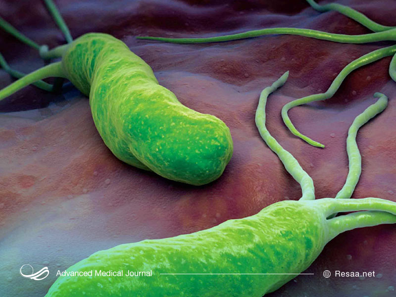 هلیکوباکتر پیلوری نوعی باکتری است که سبب التهاب در پوشش معده میشود.