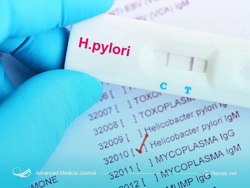 برای تشخیص هلیکوباکتر از آندوسکوپی استفاده میشود.