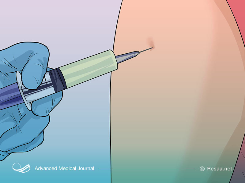 واکسن اچ پی وی