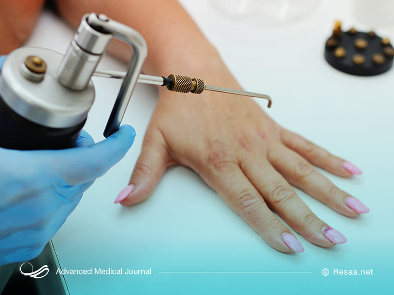 راههای درمان زگیل تناسلی