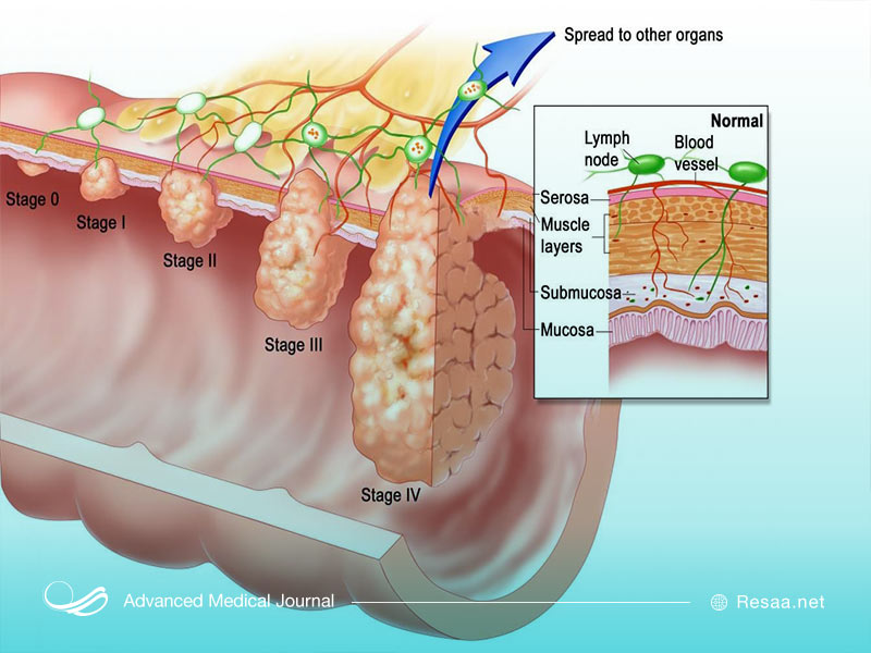 آزمایشات مخصوص برای تشخیص اچ پی وی