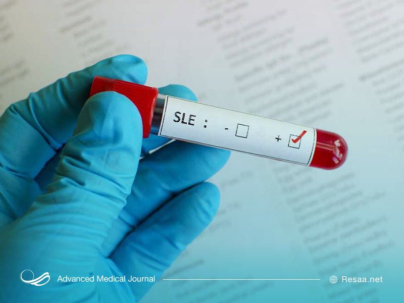 آسیب به رگهای خونی در بیماری لوپوس شایع است