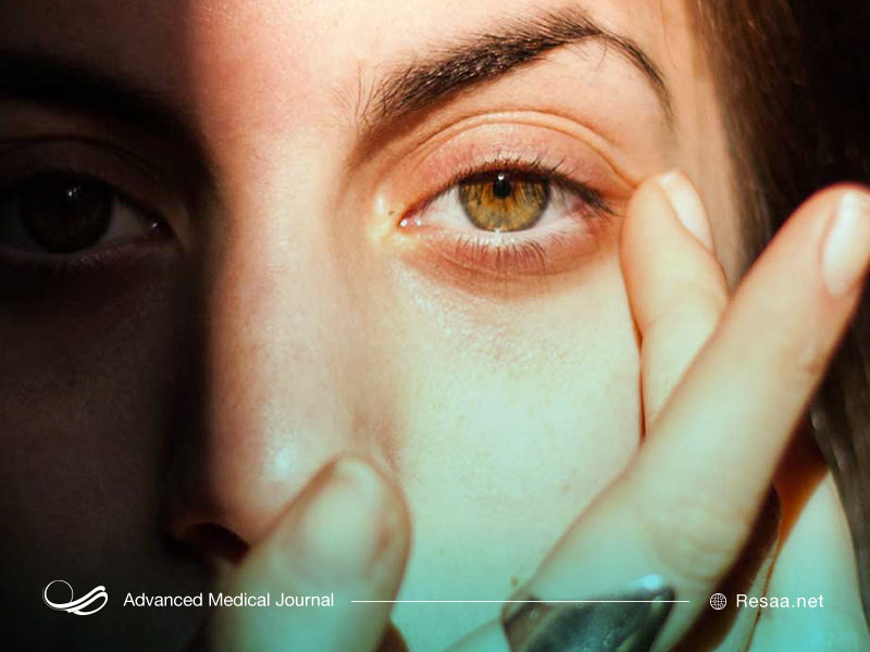 پلک چشم شما ممکن است به دلایل مختلفی دچار پرش شود.