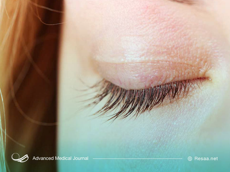 پرش پلک چشم دلایل عصبی دارد.