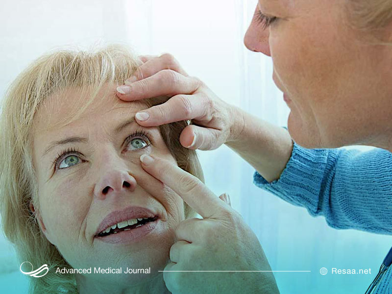 برای تشخیص علت اصلی پرش پلک بهتر است به متخصص مراجعه کنیم.