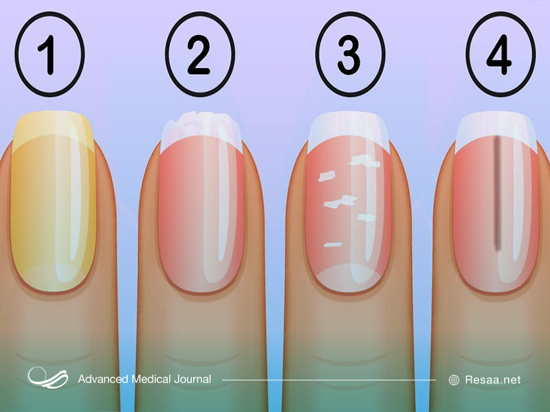 کوتاه کردن ناخنها به طور مرتب