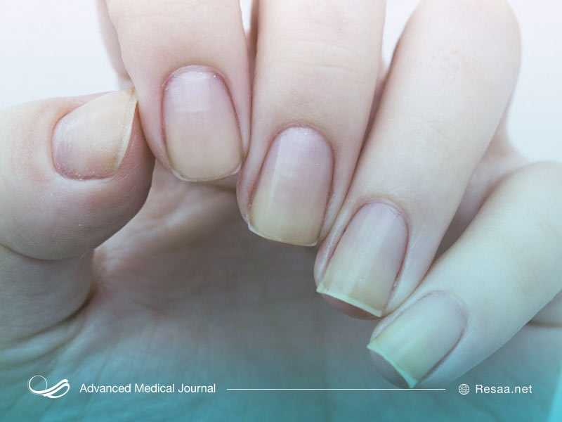 نحوه استفاده از ناخن مصنوعی