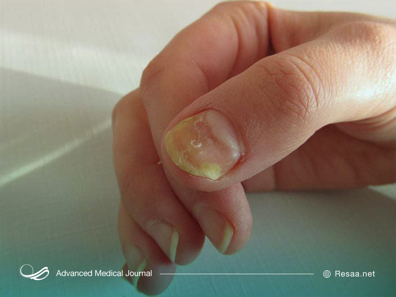 استحکام ناخنها