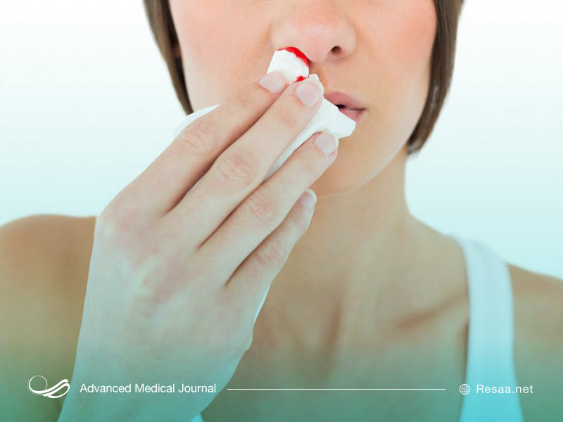 هوای خشک یکی از عوامل خون دماغ شدن است