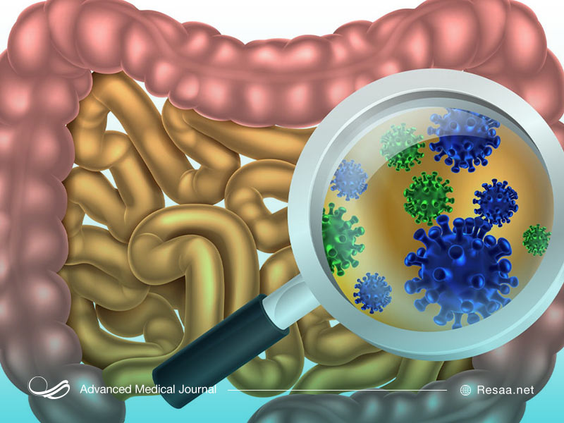 زخم معده چیست و چگونه ایجاد میشود؟
