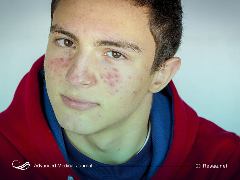 سردرگمی والدین هنگام بلوغ زودرس فرزندان