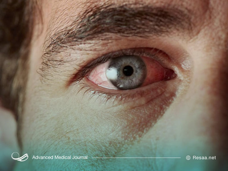 رتینوپاتی دیابتی میتواند منجر به از دست دادن بینایی شود