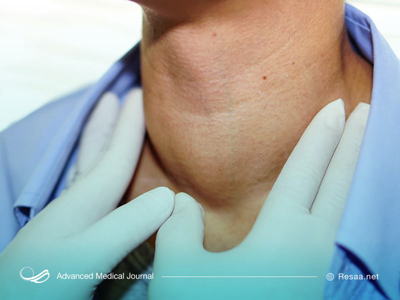 گره یا ندولهای تیروئیدی با معاینه پزشک تشخیص داده می شوند.