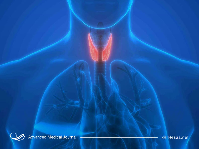 گره یا ندول تیروئیدی ممکن است سرطانی باشد یا تنها منجر به پرکاری تیروئید شود.