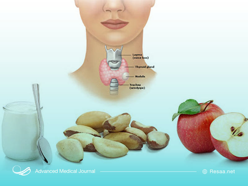 رژیم غذایی در پیشگیری از ابتلا به ندول تیروسید بسیار مهم است.