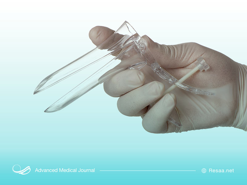 بررسی سلامت دهانه رحم