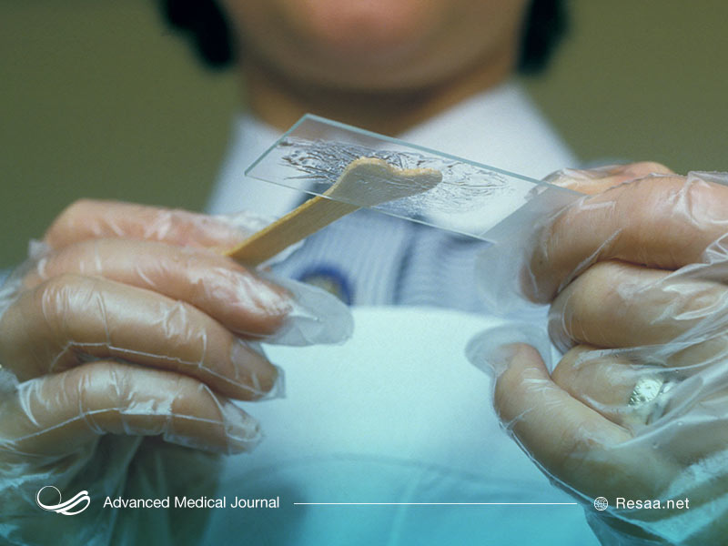 در چه شرایطی از این تست استفاده کنیم؟