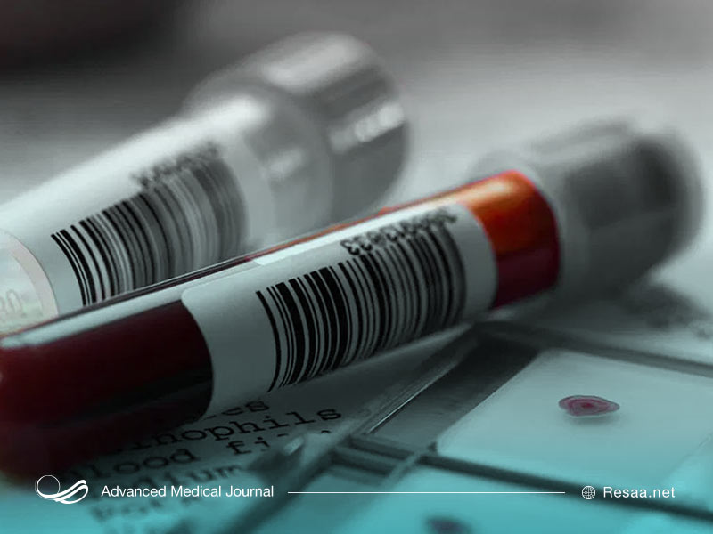 مدیریت بیماری آدیسون