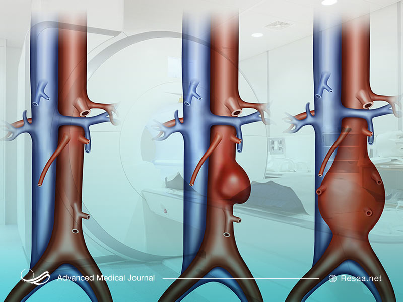 آسیب دیدگی شریانها