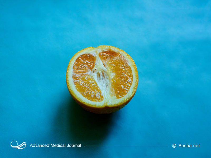 درمان کیست بارتولین