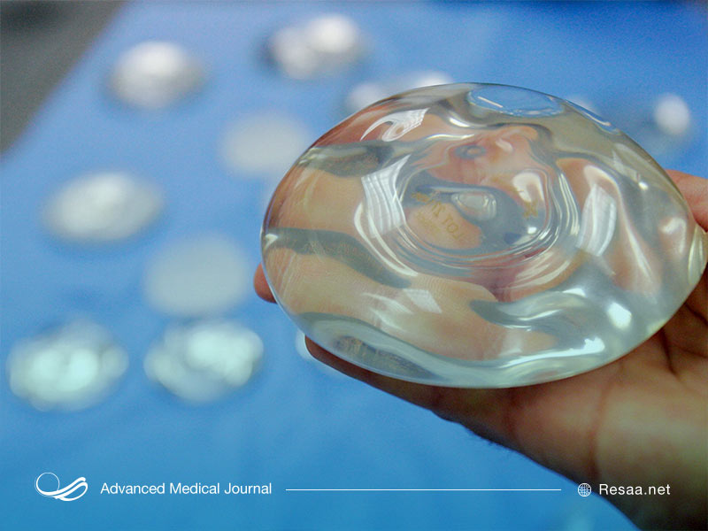 ایمپلنت سینه ها