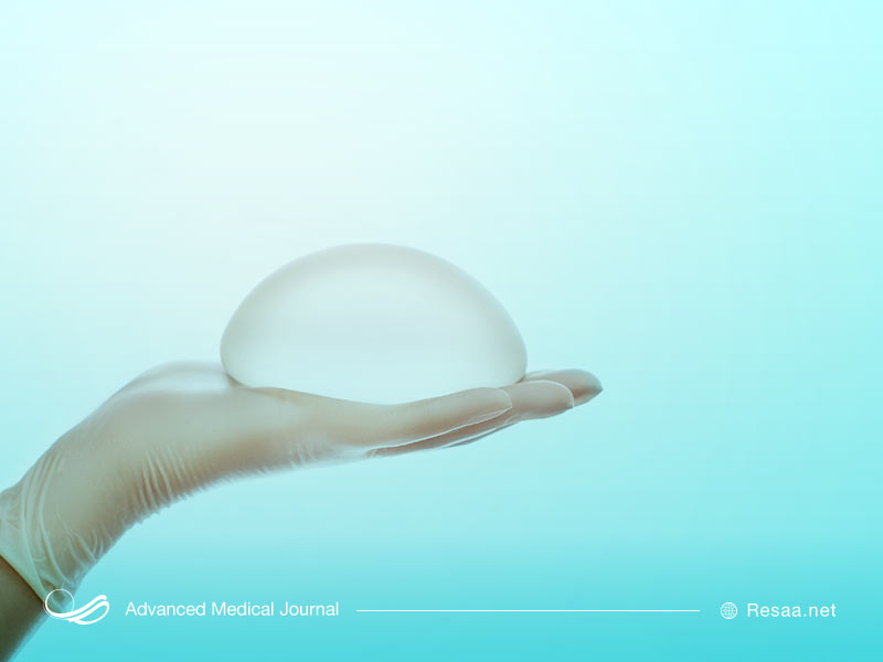 بازسازی بافت سینه امکان بازگشت سرطان را بیشتر نمیکند