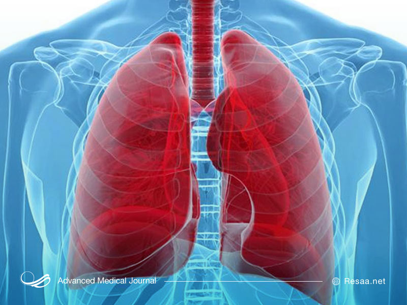 دیسفاژی چیست؟