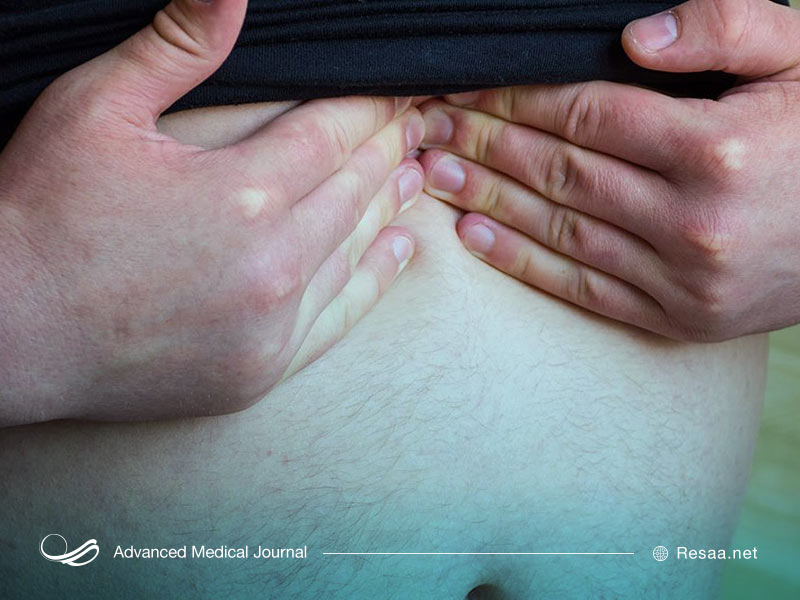 باد فتق هنگامی اتفاق می‌افتد که محتویات یک حفره بدن، از ناحیه‌ای که در آن به طور عادی قرار دارد خارج می‌شود.