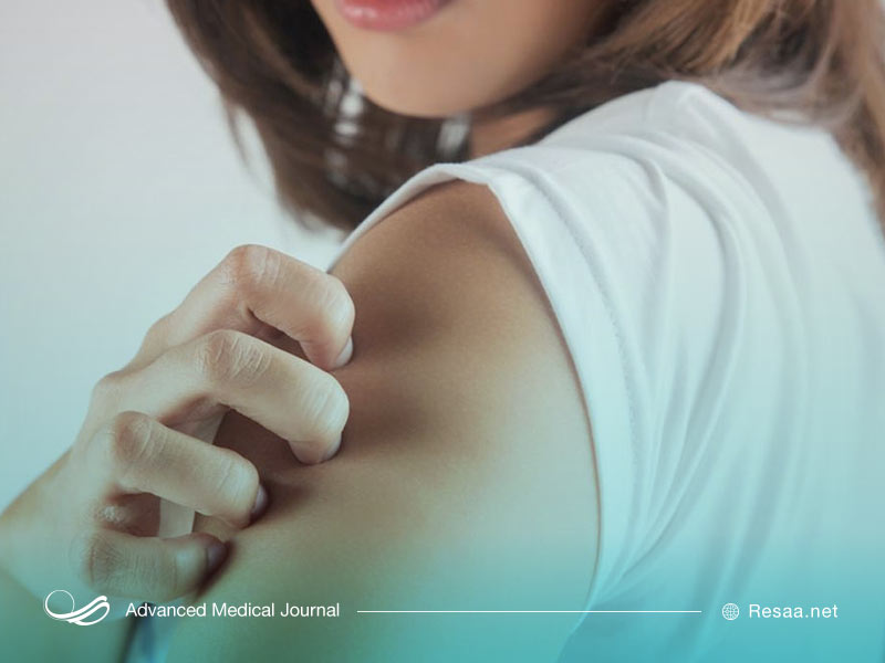 ضعف سیستم ایمنی بدن میتواند در ایجاد زونا نقش داشته باشد