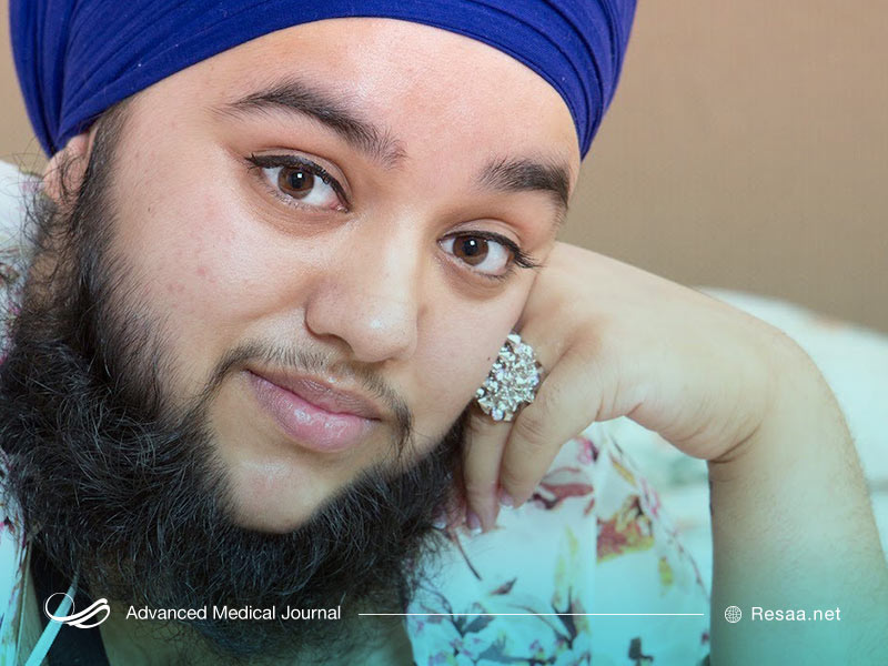 آمارها درباره پرمویی چه میگویند