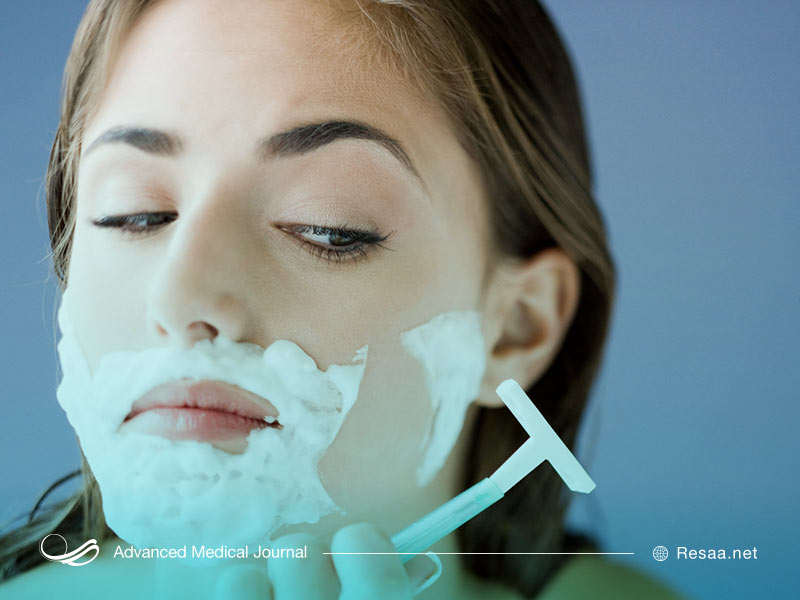 نقش هورمونها در پرمویی