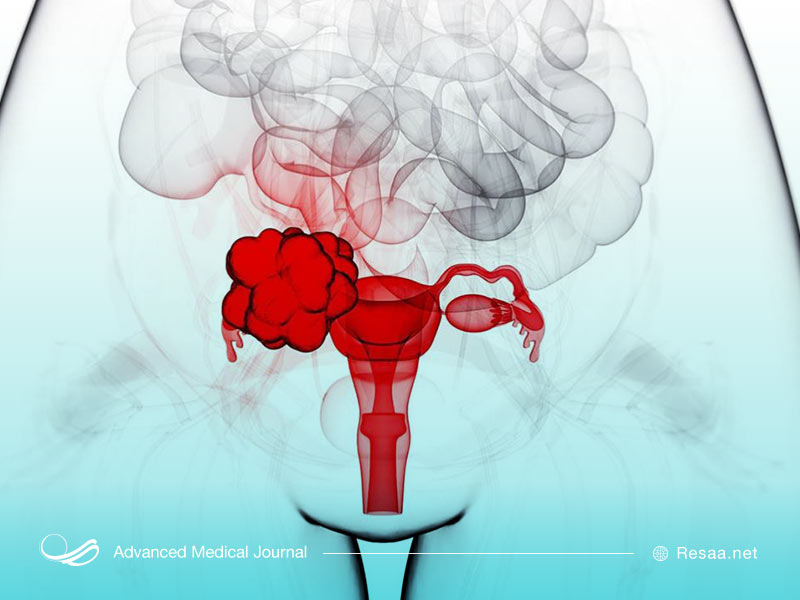 درمان قاعدگی نامنظم