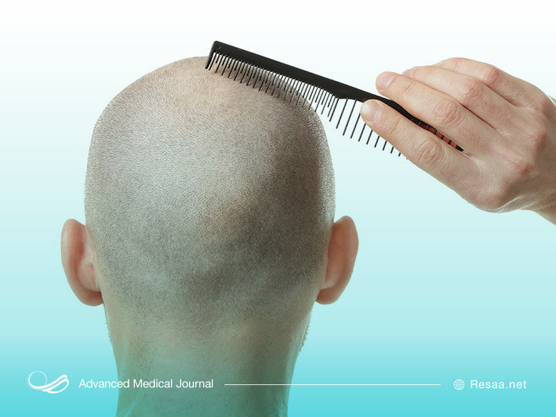 مراقبت از موها