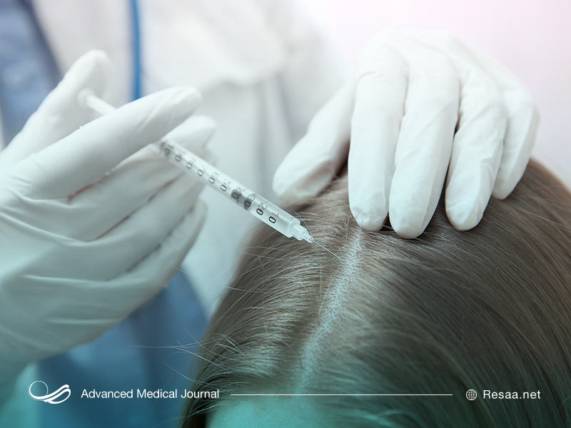 اثرات مزوتراپی