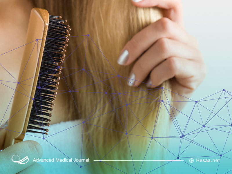 انواع ریزش مو