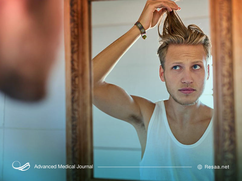 تشخیص چربی موها