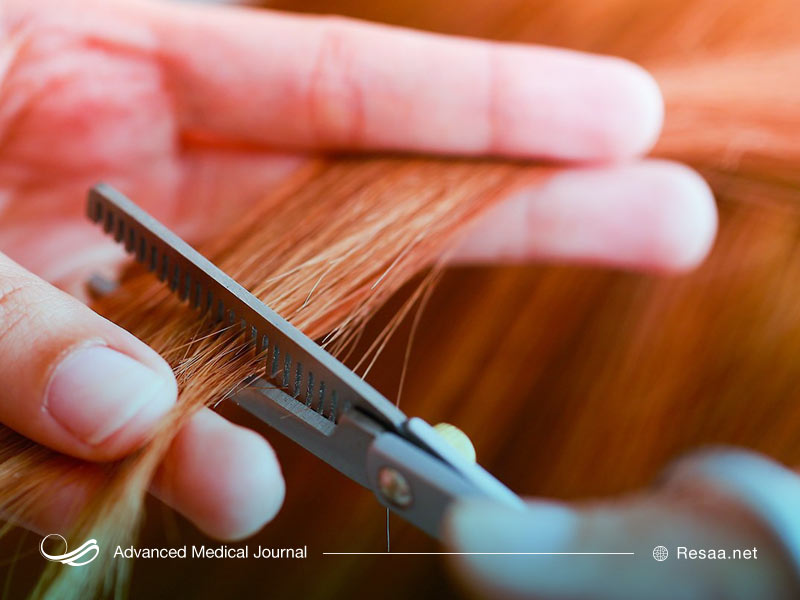 استرس عاملی مهم برای ضعیف شدن موهای سر