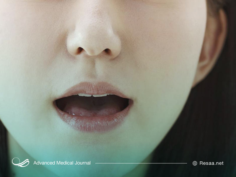 انواع اختلالات گفتاری