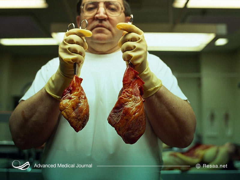 ضخیم شدن دیواره قلب