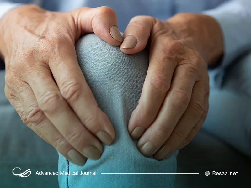 رابطه اضافه وزن و ارتروز زانو