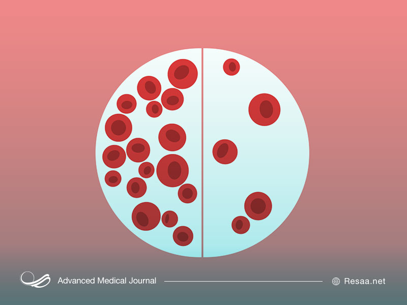 انواع کم خونی