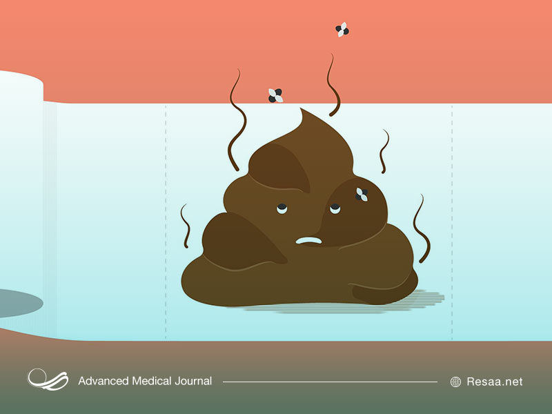 تشخیص وجود خون در مدفوع