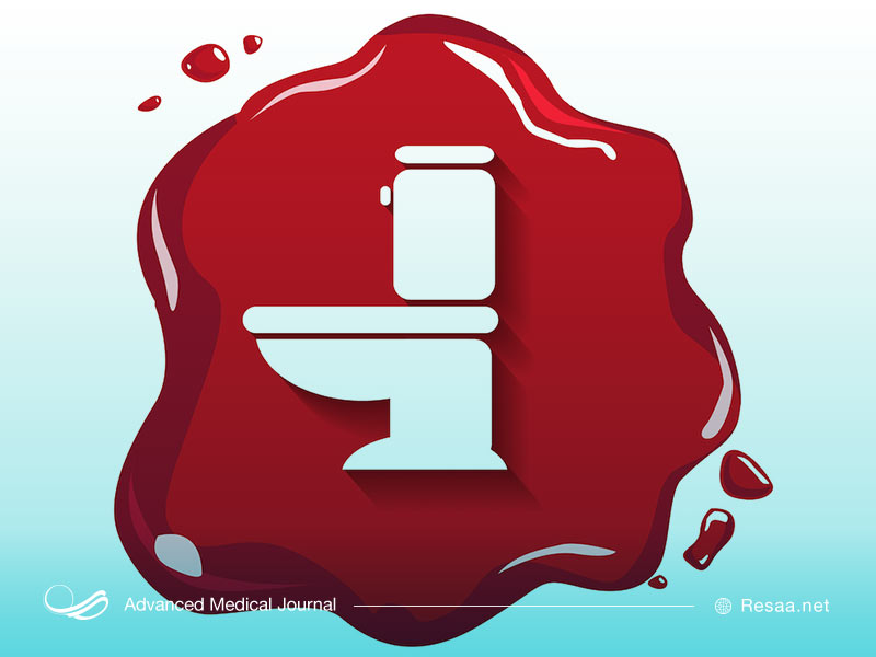 خونریزی مقعدی میتواند باعث کم خونی شود