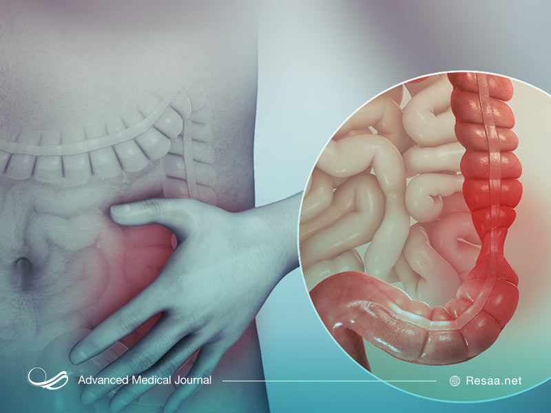 پیشگیری از خونریزی مقعدی