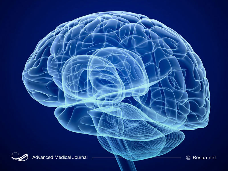 اتروفی مغزی چیست؟