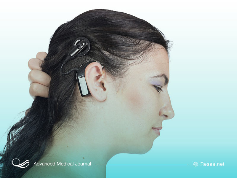 کارکرد ایمپلنت حلزونی چگونه است