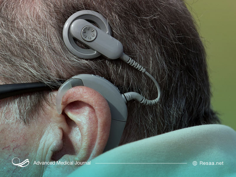 موفقیت در کاشت حلزونی