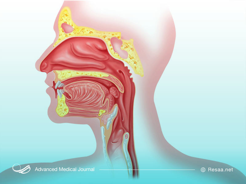 نکاتی درباره ازوفاژیت