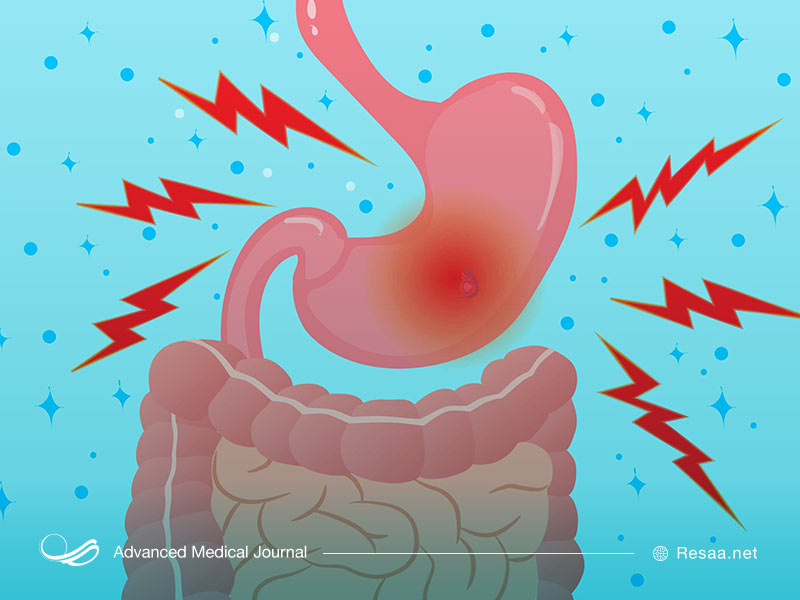 مصرف الکل و مواد شوینده التهاب مری را تشدید میکنند