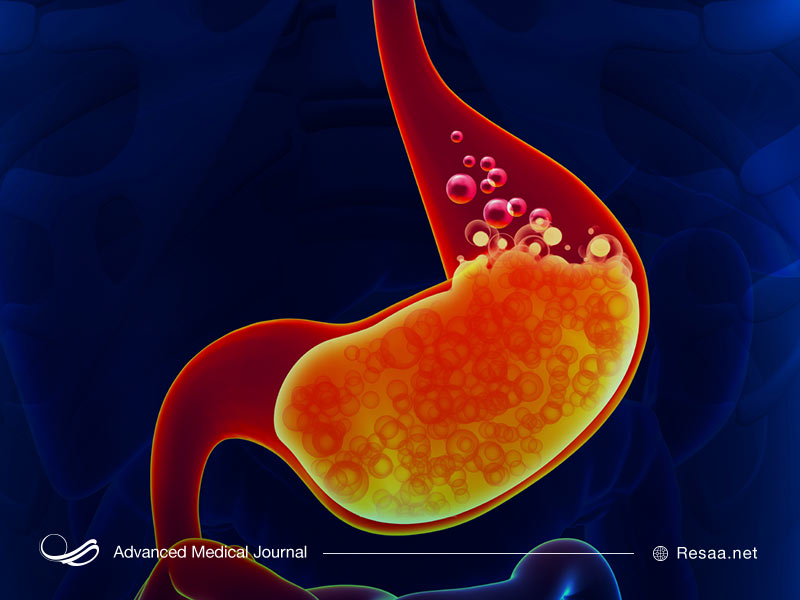 روشهای درمان التهاب مری